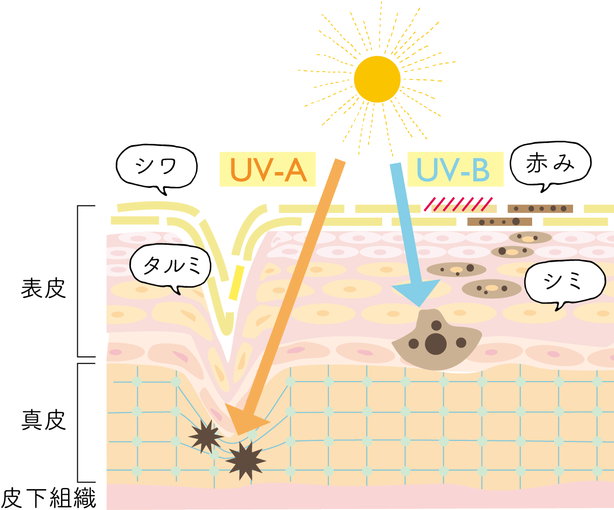 紫外線を浴びた時のイメージ